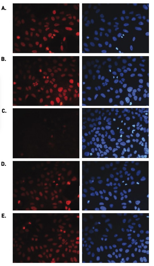 H3K36me1 Antibody in Immunocytochemistry (ICC/IF)