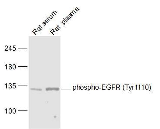 Phospho-EGFR (Tyr1110) Antibody in Western Blot (WB)