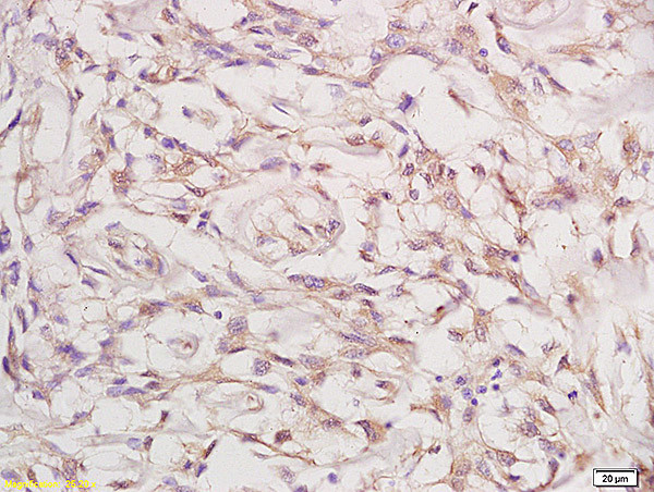 Phospho-FGFR1/FGFR2 (Tyr463, Tyr466) Antibody in Immunohistochemistry (Paraffin) (IHC (P))