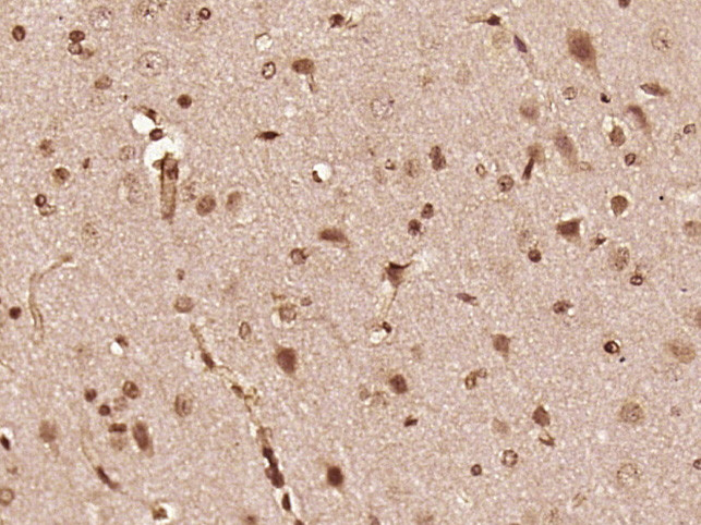 Phospho-FGFR1/FGFR2 (Tyr463, Tyr466) Antibody in Immunohistochemistry (Paraffin) (IHC (P))