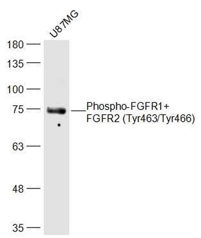 Phospho-FGFR1/FGFR2 (Tyr463, Tyr466) Antibody in Western Blot (WB)