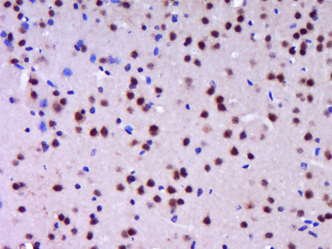 Phospho-mTOR (Thr2446) Antibody in Immunohistochemistry (Paraffin) (IHC (P))