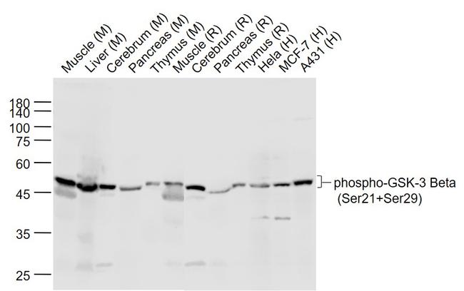 Phospho-GSK-3 Beta (Ser21, Ser29) Antibody in Western Blot (WB)
