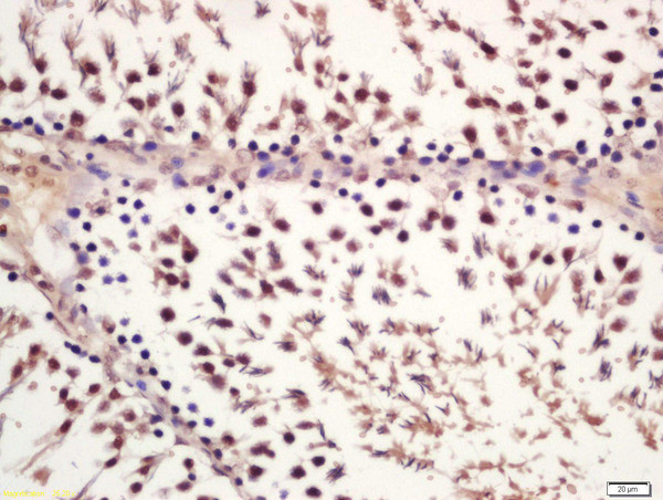 Phospho-GSK-3 Beta (Ser21) Antibody in Immunohistochemistry (Paraffin) (IHC (P))