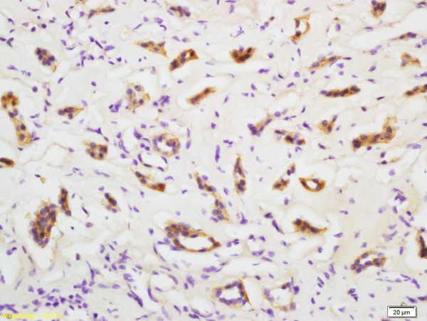 PMVK Antibody in Immunohistochemistry (Paraffin) (IHC (P))