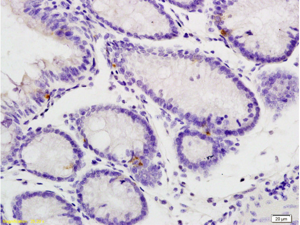 Phospho-IL-1R1 (Tyr496) Antibody in Immunohistochemistry (Paraffin) (IHC (P))