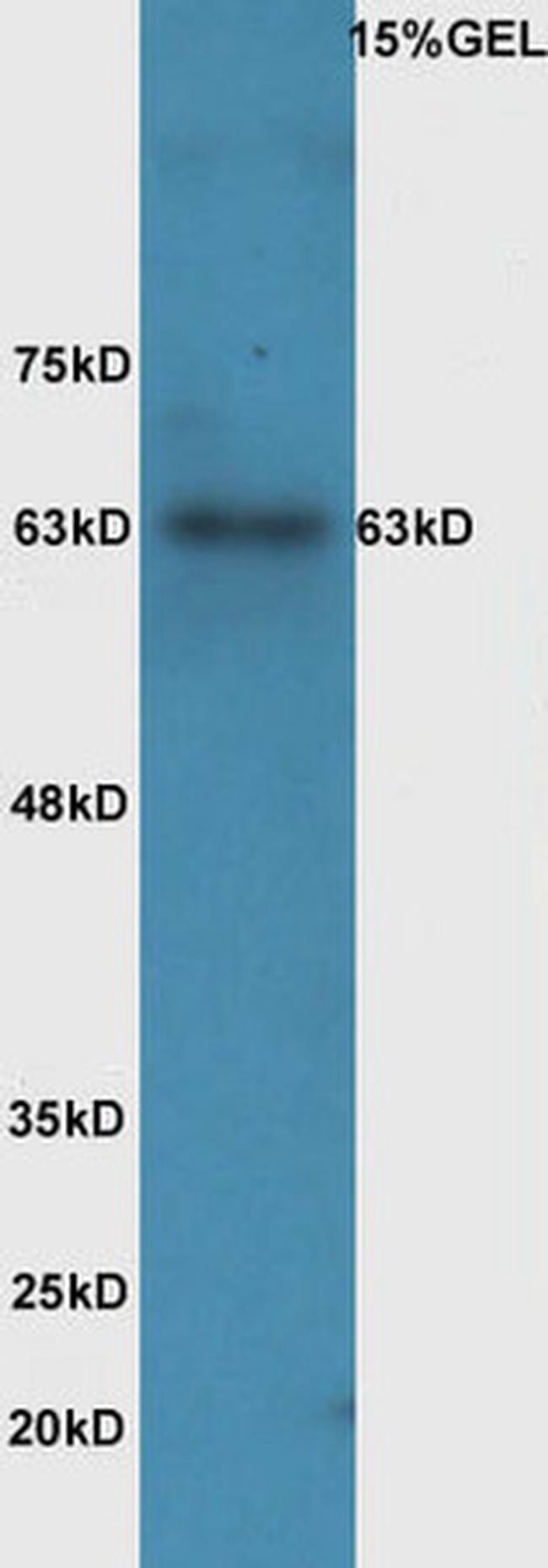 Phospho-IL-1R1 (Tyr496) Antibody in Western Blot (WB)