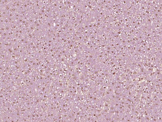 Phospho-CK18 (Ser60) Antibody in Immunohistochemistry (Paraffin) (IHC (P))