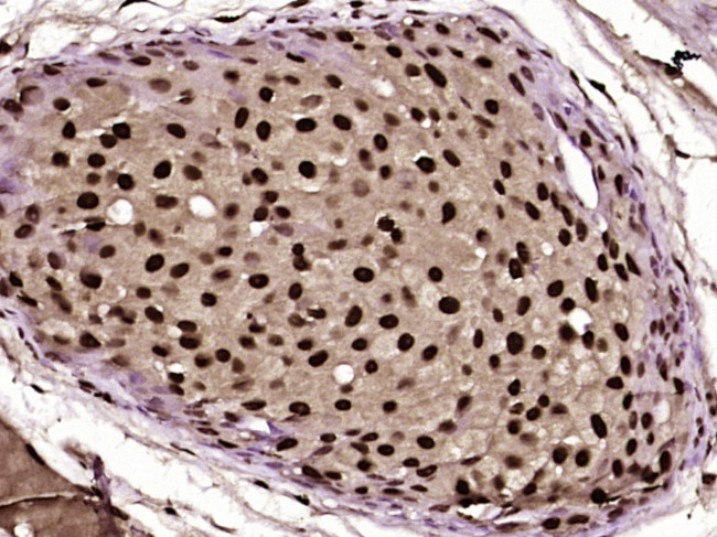 Phospho-CK18 (Ser60) Antibody in Immunohistochemistry (Paraffin) (IHC (P))