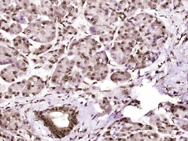 Phospho-CK18 (Ser60) Antibody in Immunohistochemistry (Paraffin) (IHC (P))