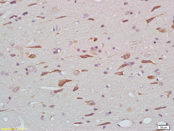 Phospho-Tau protein (Thr212) Antibody in Immunohistochemistry (Paraffin) (IHC (P))