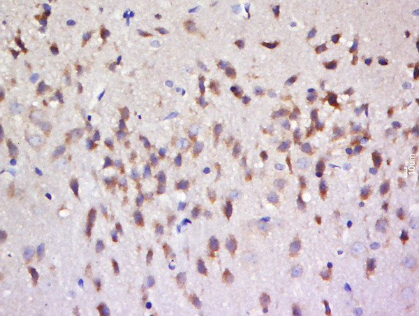 Phospho-Tau protein (Ser356) Antibody in Immunohistochemistry (Paraffin) (IHC (P))