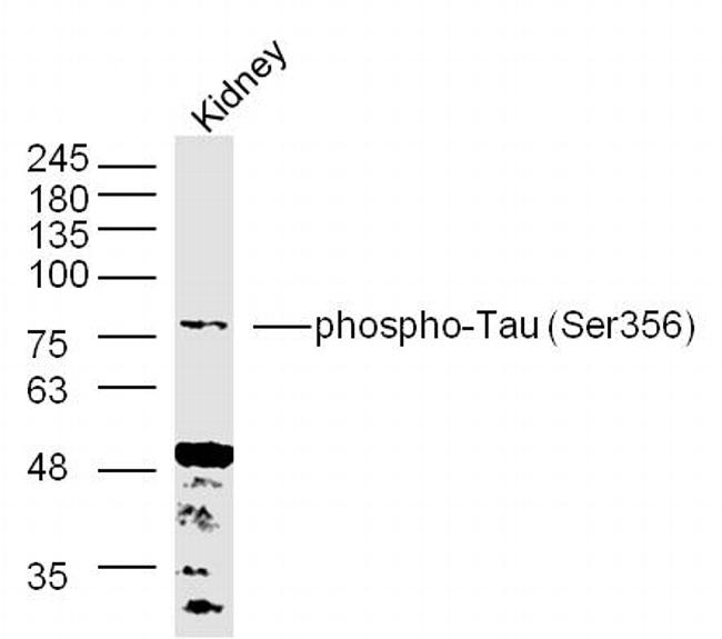 Phospho-Tau protein (Ser356) Antibody in Western Blot (WB)