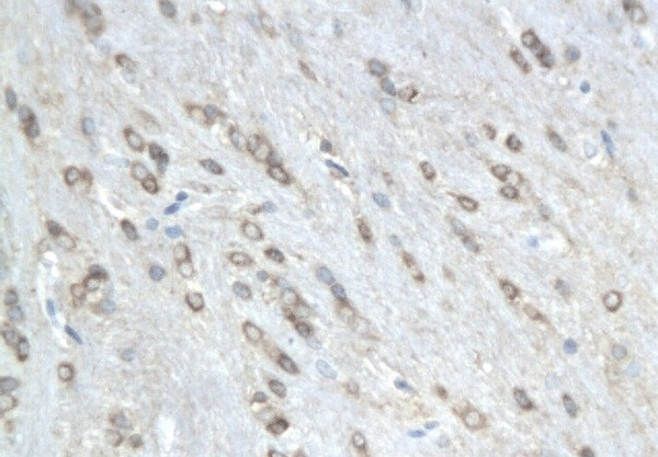 Phospho-MAP4 (Ser941) Antibody in Immunohistochemistry (Paraffin) (IHC (P))