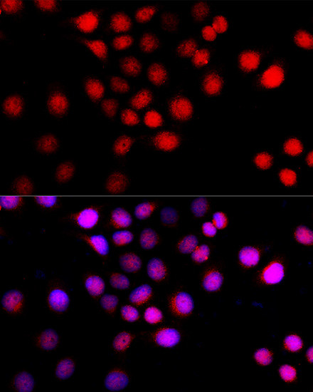 Beclin 1 Antibody in Immunocytochemistry (ICC/IF)