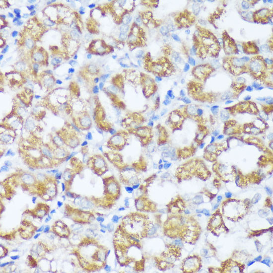 Beclin 1 Antibody in Immunohistochemistry (Paraffin) (IHC (P))