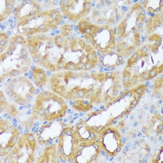 Beclin 1 Antibody in Immunohistochemistry (Paraffin) (IHC (P))