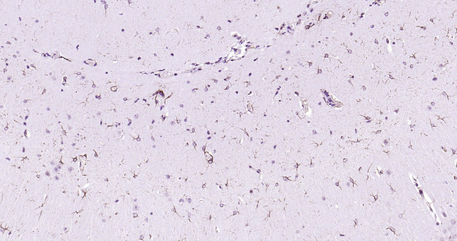 Beclin 1 Antibody in Immunohistochemistry (Paraffin) (IHC (P))