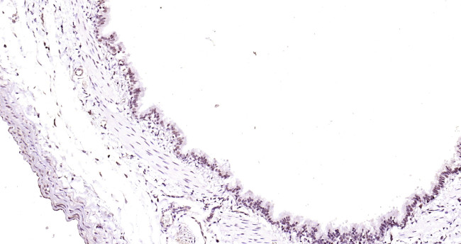 Beclin 1 Antibody in Immunohistochemistry (Paraffin) (IHC (P))