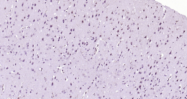 Beclin 1 Antibody in Immunohistochemistry (Paraffin) (IHC (P))