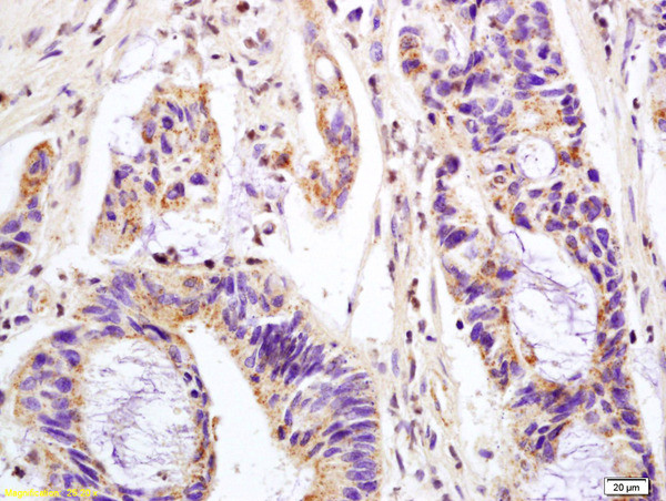 Phospho-MAPK11 (Thr180, Tyr182) Antibody in Immunohistochemistry (Paraffin) (IHC (P))