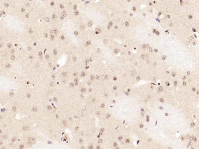 Phospho-NFKB1 (Ser337) Antibody in Immunohistochemistry (Paraffin) (IHC (P))