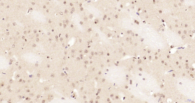 Phospho-NFKB1 (Ser337) Antibody in Immunohistochemistry (Paraffin) (IHC (P))