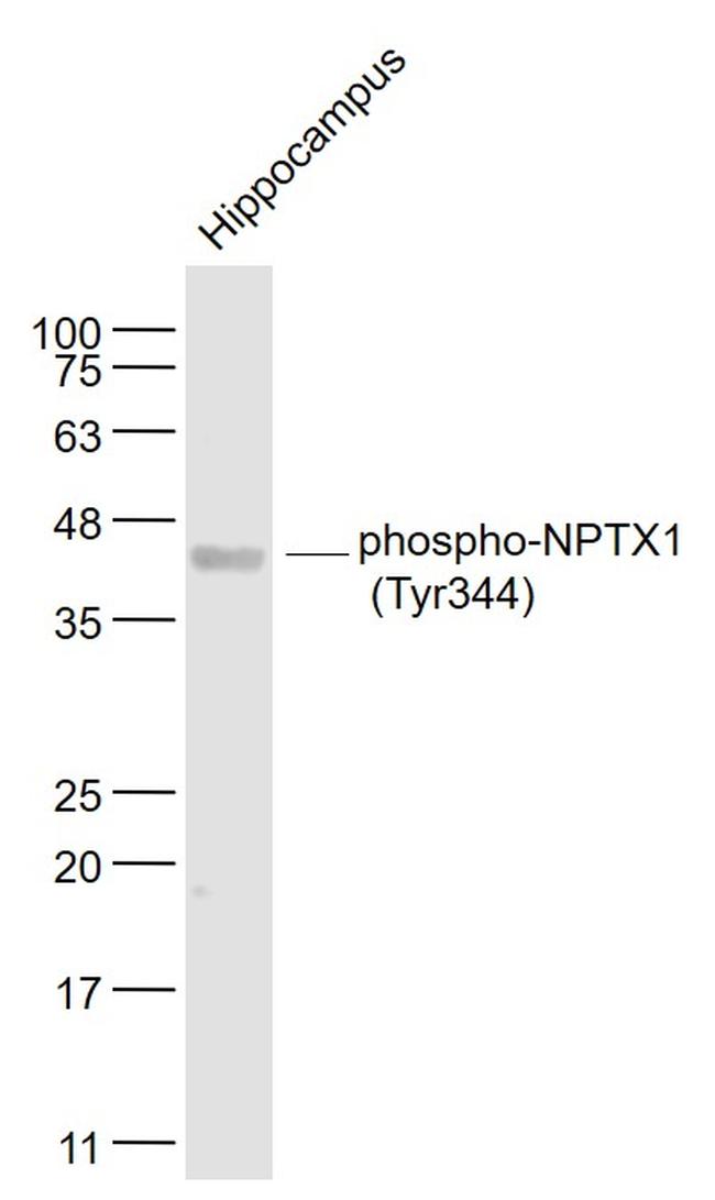 Phospho-NPTX1 (Tyr344) Antibody in Western Blot (WB)