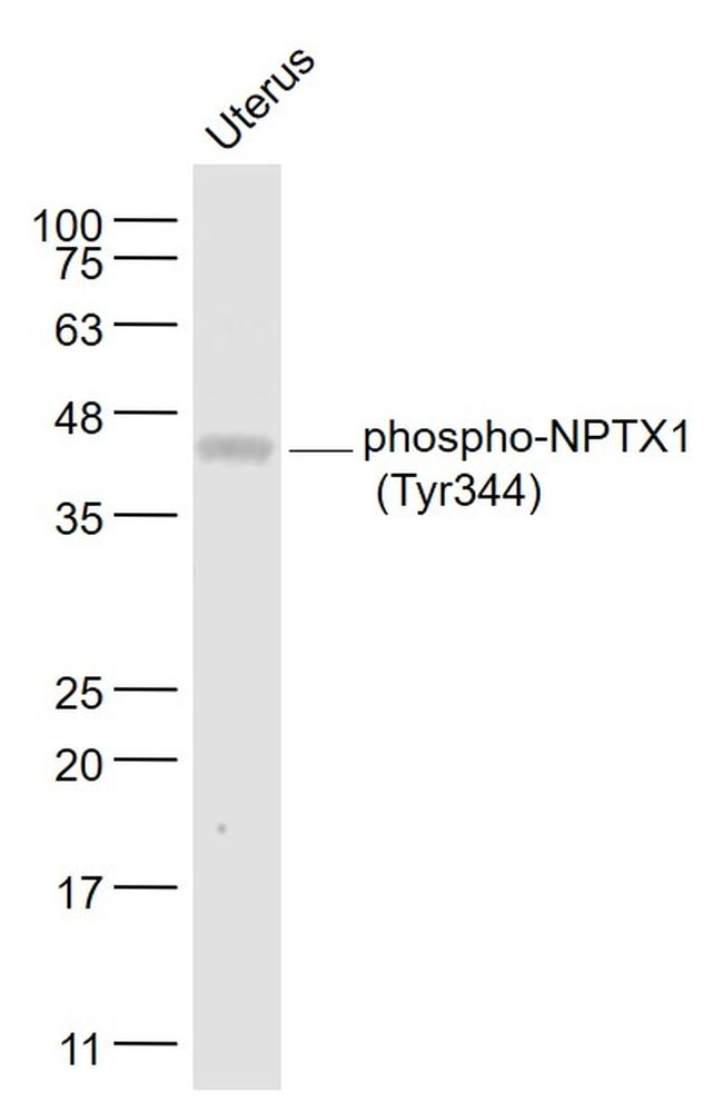 Phospho-NPTX1 (Tyr344) Antibody in Western Blot (WB)