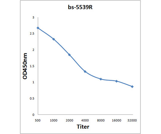 Phospho-FAK (Ser722) Antibody in ELISA (ELISA)