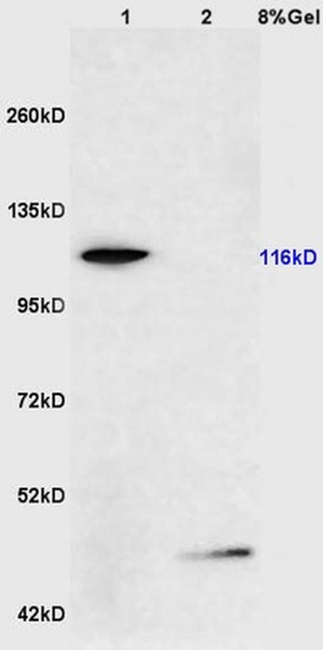 Phospho-FAK (Ser722) Antibody in Western Blot (WB)