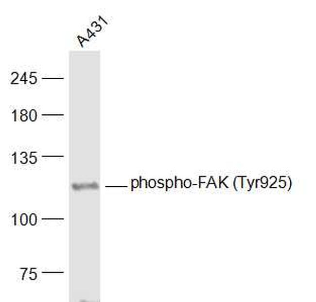 Phospho-FAK (Tyr925) Antibody in Western Blot (WB)