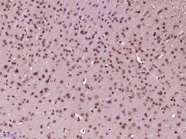 Phospho-AMPK alpha-1 (Thr198) Antibody in Immunohistochemistry (Paraffin) (IHC (P))