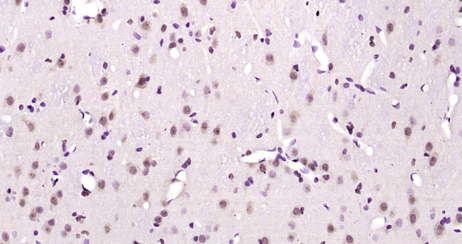 Phospho-AMPK alpha-1 (Thr198) Antibody in Immunohistochemistry (Paraffin) (IHC (P))