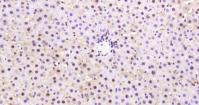 Phospho-AMPK alpha-1 (Thr198) Antibody in Immunohistochemistry (Paraffin) (IHC (P))