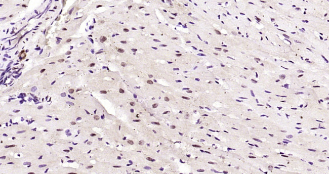 Phospho-AMPK alpha-1 (Thr198) Antibody in Immunohistochemistry (Paraffin) (IHC (P))