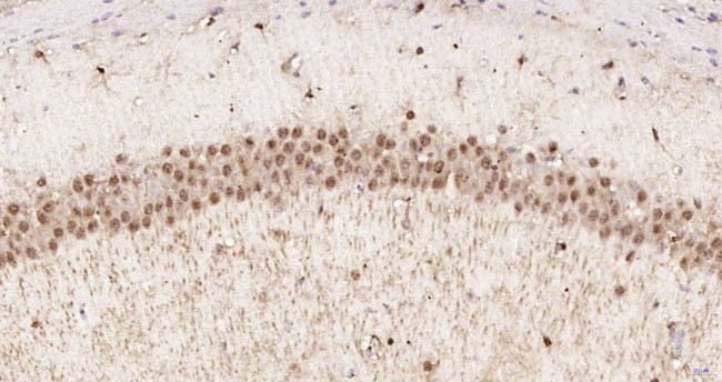 Phospho-AMPK alpha-1 (Thr198) Antibody in Immunohistochemistry (Paraffin) (IHC (P))