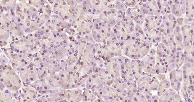 Phospho-AMPK alpha-1 (Thr198) Antibody in Immunohistochemistry (Paraffin) (IHC (P))