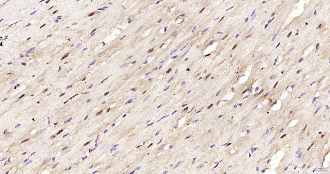 Phospho-AMPK alpha-1 (Thr198) Antibody in Immunohistochemistry (Paraffin) (IHC (P))