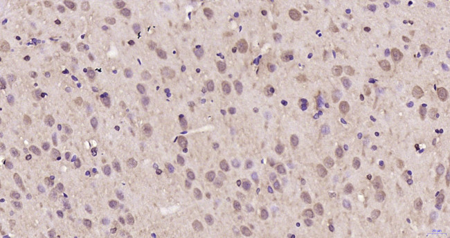 Phospho-AMPK alpha-1 (Thr198) Antibody in Immunohistochemistry (Paraffin) (IHC (P))