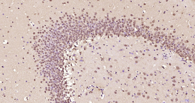 Phospho-AMPK alpha-1 (Thr198) Antibody in Immunohistochemistry (Paraffin) (IHC (P))