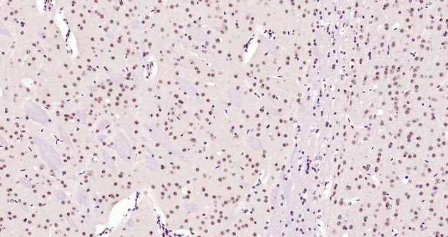 Phospho-AMPK alpha-1 (Thr198) Antibody in Immunohistochemistry (Paraffin) (IHC (P))