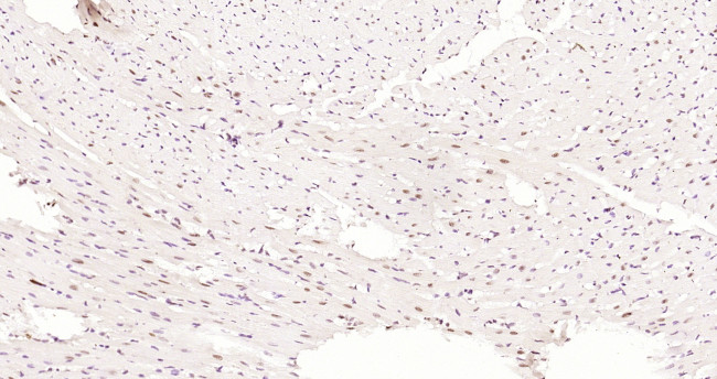 Phospho-AMPK alpha-1 (Thr198) Antibody in Immunohistochemistry (Paraffin) (IHC (P))