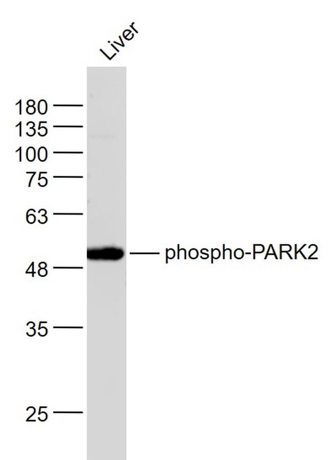 Phospho-PARK2 (Ser378) Antibody in Western Blot (WB)