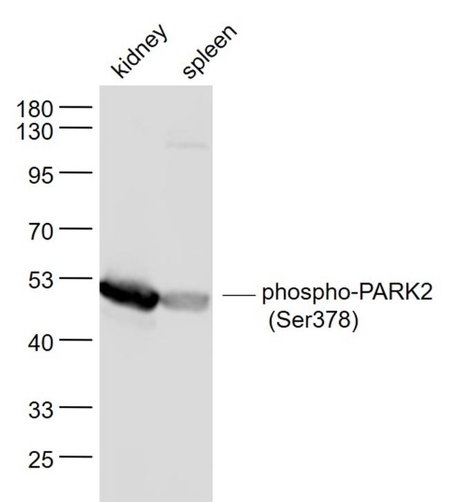 Phospho-PARK2 (Ser378) Antibody in Western Blot (WB)