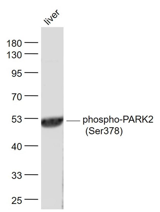 Phospho-PARK2 (Ser378) Antibody in Western Blot (WB)