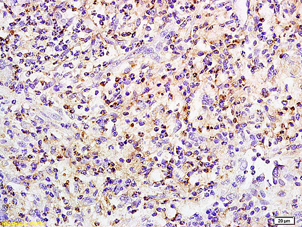 Phospho-PKC beta 1 (Ser642) Antibody in Immunohistochemistry (Paraffin) (IHC (P))