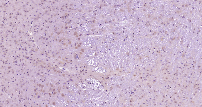 Phospho-PI3KCA (Tyr317) Antibody in Immunohistochemistry (Paraffin) (IHC (P))