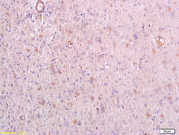 Phospho-PRKCQ (Thr538) Antibody in Immunohistochemistry (Paraffin) (IHC (P))