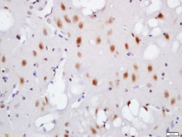 Phospho-TNIK (Ser764) Antibody in Immunohistochemistry (Paraffin) (IHC (P))